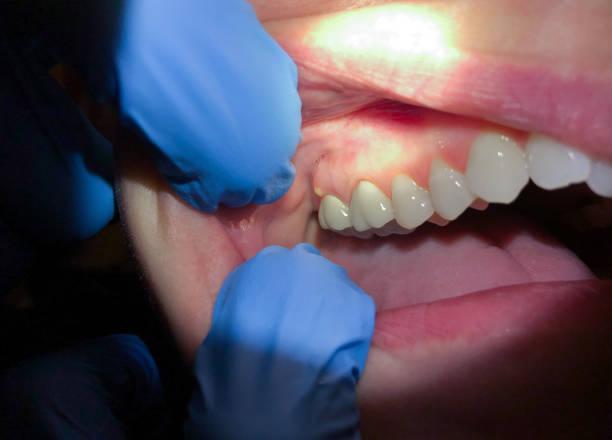 Best Orthodontic Emergency Dentist in Mayfield, PA