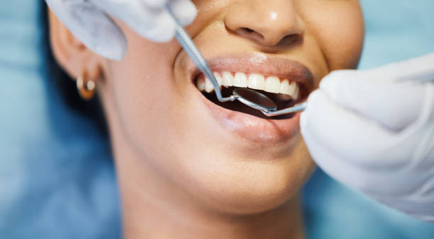 Best Emergency Dentist for Knocked-Out Tooth in Mayfield, PA